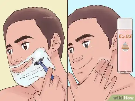 Image titled Use Bio Oil Step 7