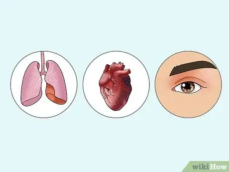 Image titled Diagnose Rheumatoid Arthritis Step 3