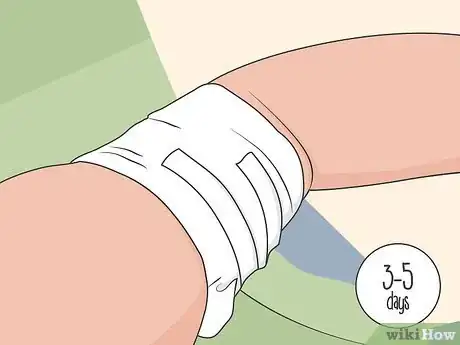 Image titled Remove Nexplanon Step 12