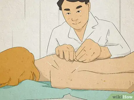 Image titled Find a Licensed Acupuncturist Step 3