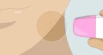 Make Epilating Hurt Less