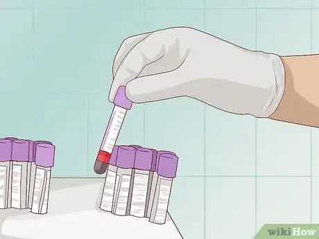 Image titled Treat Chronic Inflammatory Demyelinating Polyneuropathy (CIDP) Step 9