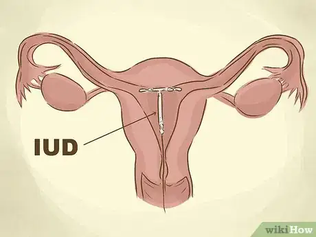 Image titled Get Rid of Cramps Step 9