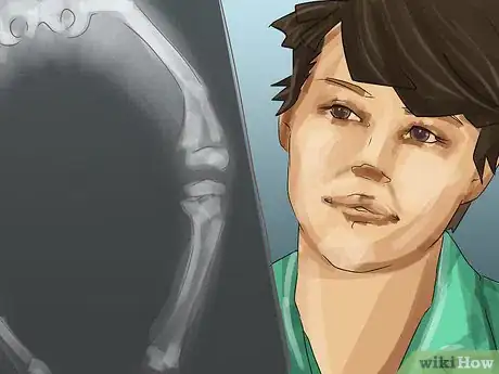 Image titled Treat Rickets Step 11