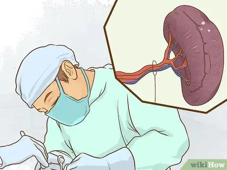 Image titled Treat Complications of Sickle Cell Disease (SCD) Step 19