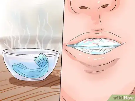 Image titled Stop Snoring by Using an Anti Snoring Mouthpiece Step 5