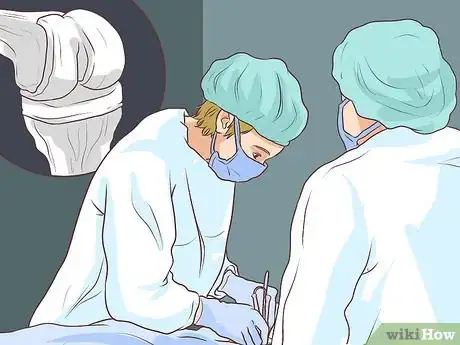 Image titled Avoid Rheumatoid Arthritis Remission Relapses Step 5