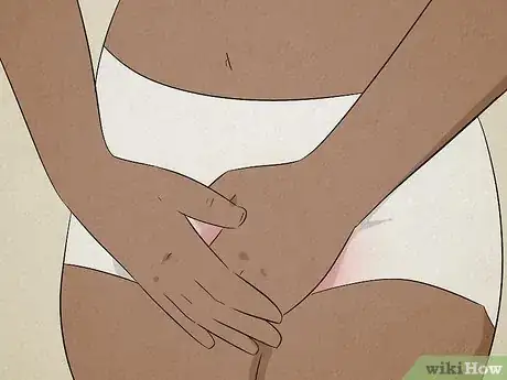 Image titled Get Rid of a Bartholin Cyst Step 9