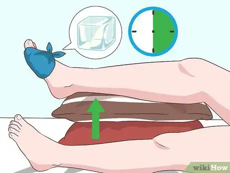 Image titled Live with Gout Step 9