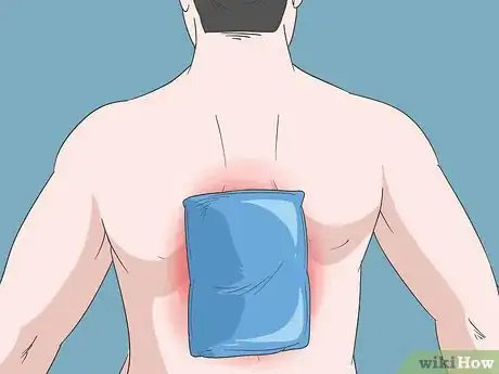 Image titled Alleviate Back Pain Naturally Step 1
