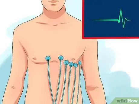 Image titled Diagnose Aortic Regurgitation Step 6