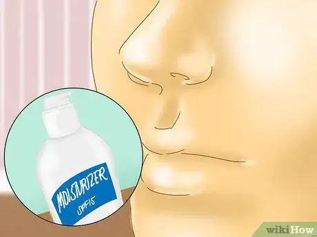Image titled Prevent Eczema Step 9