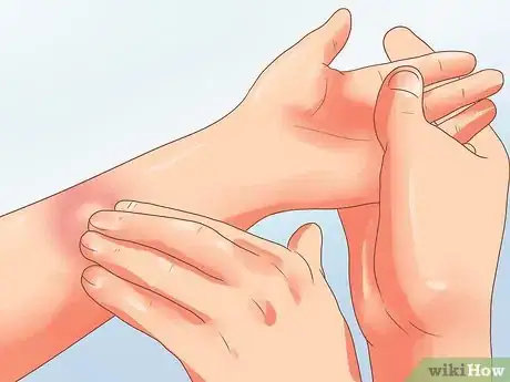 Image titled Prevent Leukemia in Children Step 13