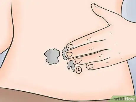 Image titled Prepare Your Body for Pregnancy Step 15