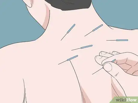 Image titled Alleviate Back Pain Naturally Step 7