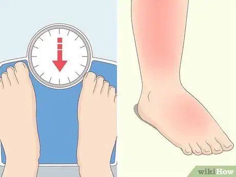 Image titled Prevent Clostridium Difficile Infections Step 16