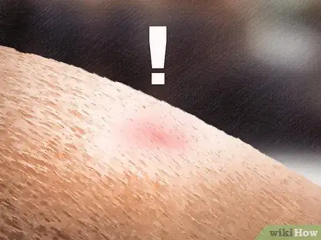 Image titled Remove a Tick from a Horse Step 17