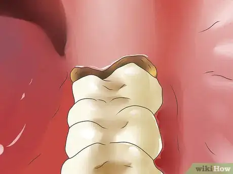 Image titled Deal With a Sore Tooth Step 10