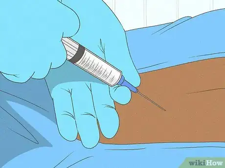 Image titled Treat Chronic Back Pain with Radio Waves Step 11