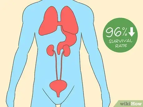 Image titled Treat Bladder Cancer Step 14