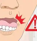 Prevent Receding Gums