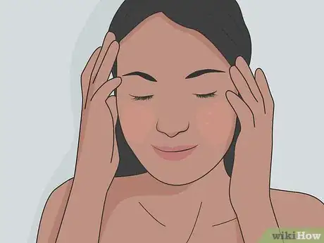 Image titled Clear Up Rosacea Without Medication Step 20