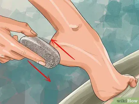 Image titled Pumice a Wart Step 2