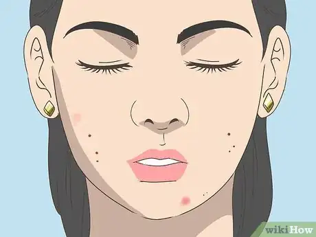 Image titled Deal with Post Birth Control Syndrome Step 3