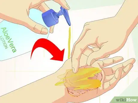 Image titled Care for Superficial Wounds Step 8