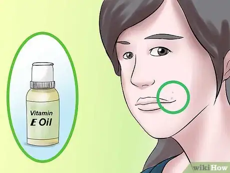 Image titled Take Out a Monroe Piercing Step 12