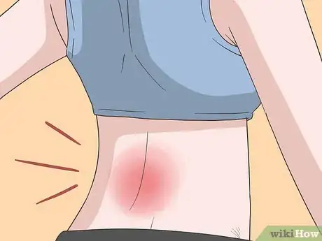 Image titled Treat Neck and Back Pain Naturally Step 19