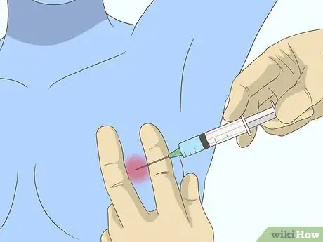 Image titled Diagnose Breast Cancer Step 10