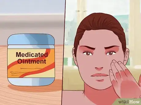 Image titled Get Rid of Age Spots Step 1