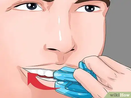 Image titled Stop Snoring by Using an Anti Snoring Mouthpiece Step 8