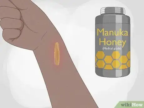 Image titled Use Herbs to Heal Step 4