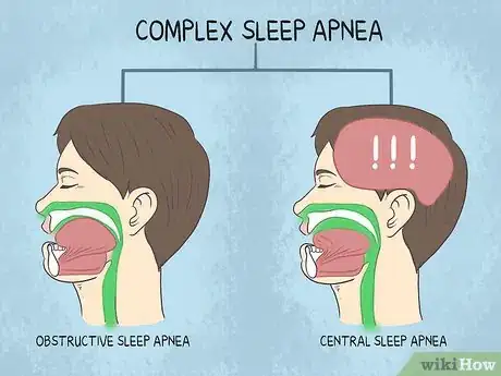 Image titled Help Someone with Sleep Apnea Step 9
