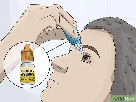 Image titled Stop Eyes from Itching from Hay Fever Step 4