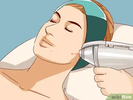 Image titled Choose Laser Skin Resurfacing Step 7
