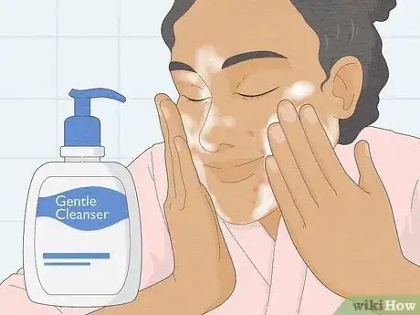 Image titled Wear Makeup when You Have Eczema Step 1