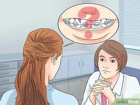 Image titled Relax While Getting New or Tightened Braces Step 12