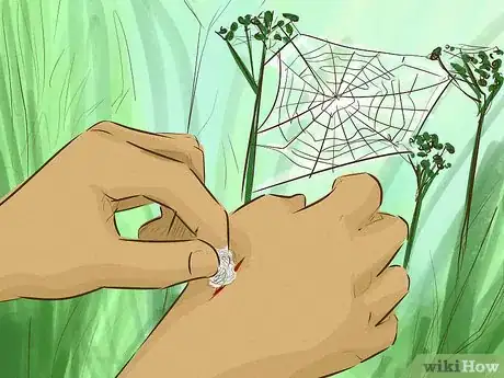 Image titled Stop Bleeding Step 7