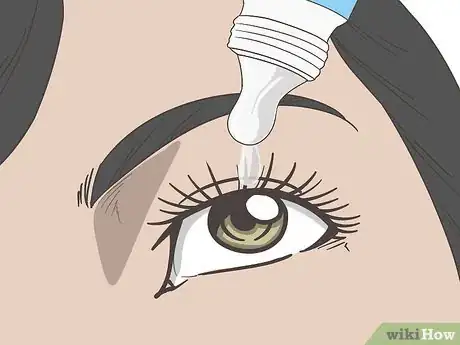 Image titled Manage Eye Disorders with Crohn's Disease Step 1