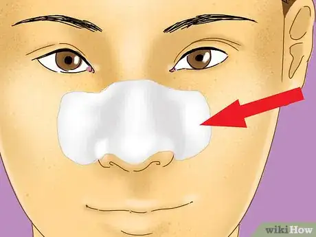 Image titled Get Rid of Blackheads and Whiteheads Using Commercial Products Step 5