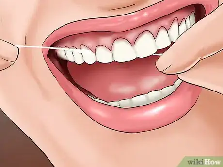Image titled Care for Your Teeth As a Senior Citizen Step 4