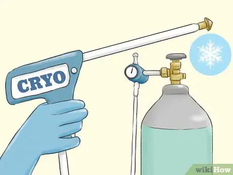 Image titled Heal Cervical Dysplasia Naturally Step 10