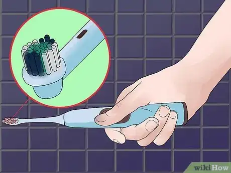 Image titled Be Happy with Braces Step 10