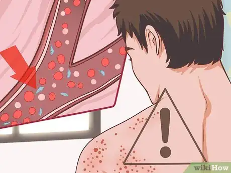 Image titled Diagnose Fanconi Anemia Step 12