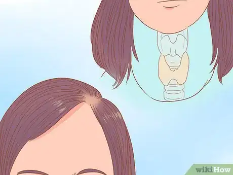 Image titled Stop Hormonal Hair Loss Step 14