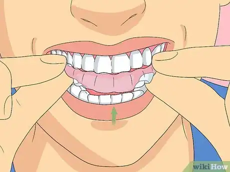 Image titled Clean Invisalign Step 11