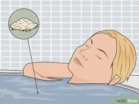 Image titled Heal Armpit Rash Step 13